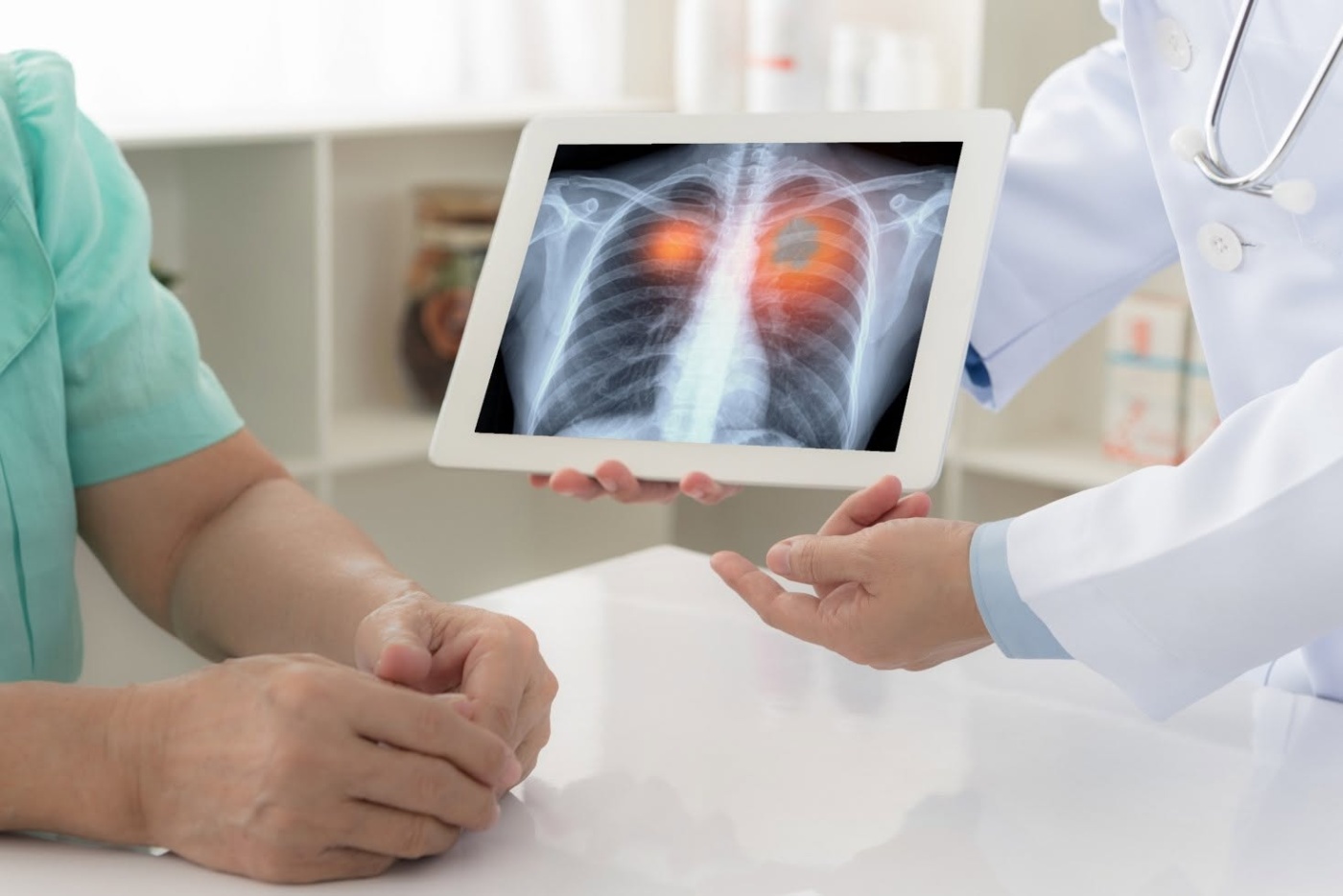 Are you at risk? Free lung cancer screening by 365 Cancer Prevention Society