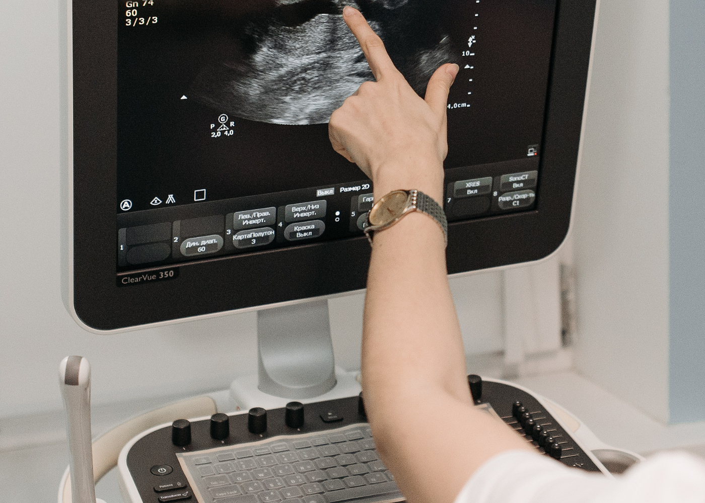 My first mammogram involved a technician removing a flake of glitter from my left boob